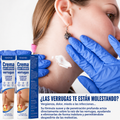 CREMA ELIMINADORA DE VERRUGAS