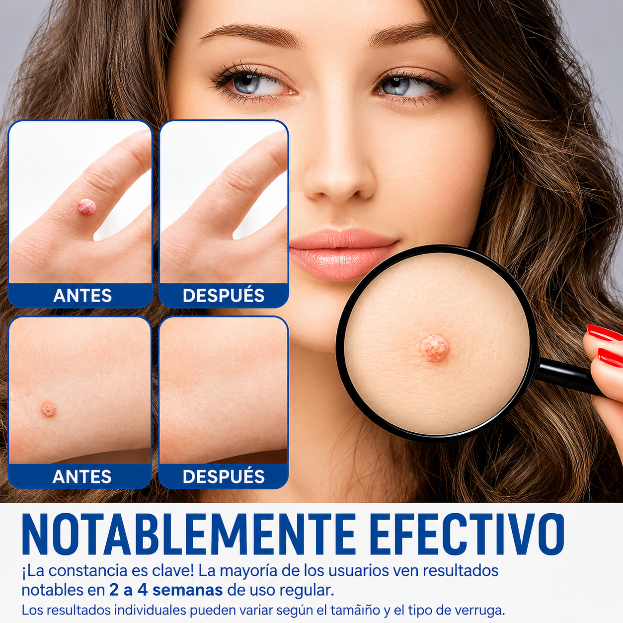 CREMA ELIMINADORA DE VERRUGAS