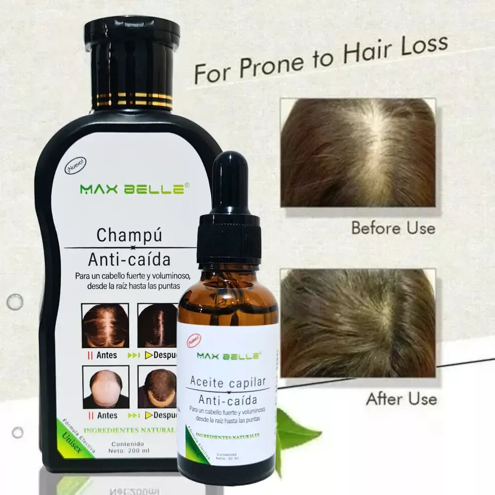 SHAMPOO ANTI CAIDA 200 ML MAX BELLEZA