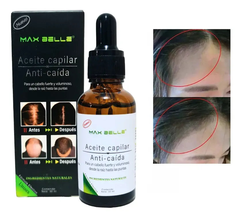 SHAMPOO ANTI CAIDA 200 ML MAX BELLEZA