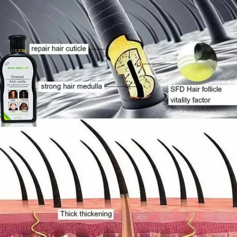 SHAMPOO ANTI CAIDA 200 ML MAX BELLEZA