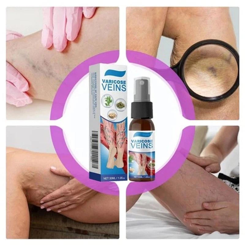 KIT VARICES SPRAY + 12 PARCH